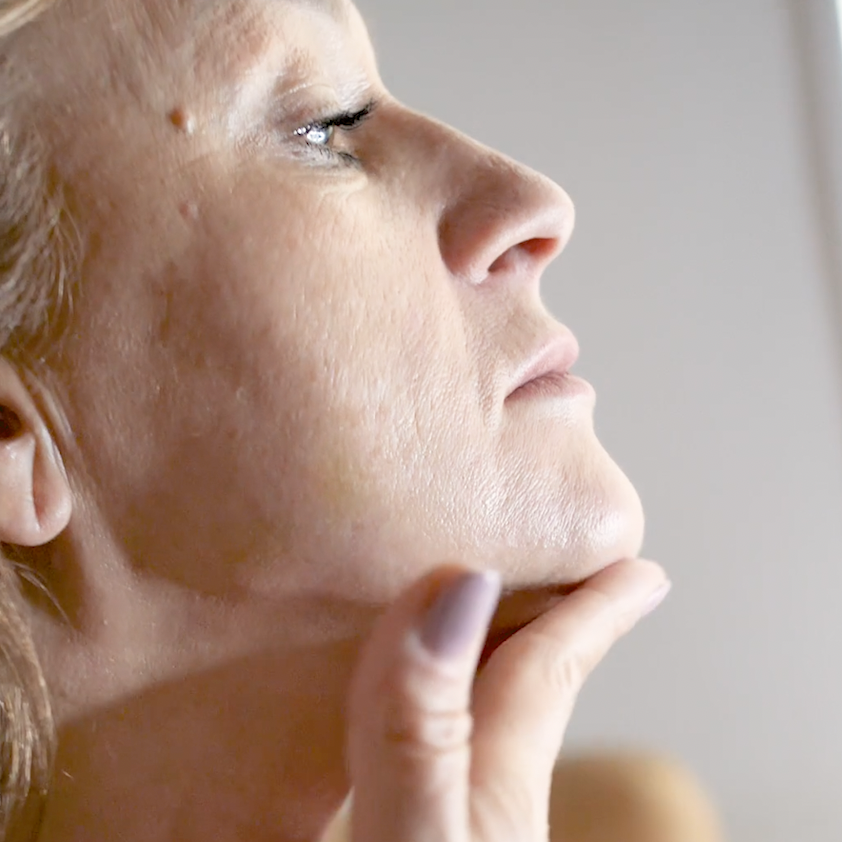 Fine Lines + Sun Damage